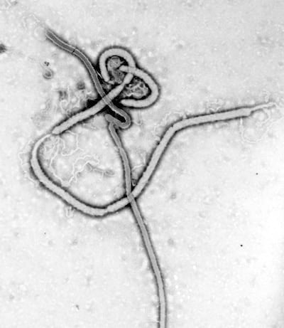 Ebola_virus_em